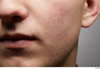  HD Face Skin Casey Schneider cheek face lips mouth nose skin pores skin texture 0001.jpg